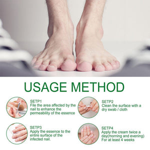 Ginger Nail Essence Fungus Treatment 30ml Nail Care No Brand