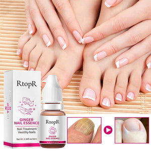 Ginger Nail Essence Repair Fungus Treatment 10ml Nail Care No Brand
