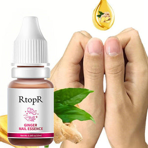 Ginger Nail Essence Repair Fungus Treatment 10ml Nail Care No Brand