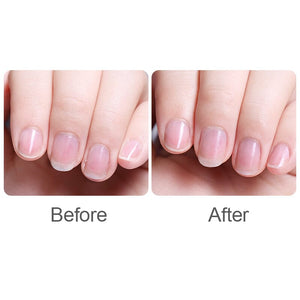 Nail Cutitle Oil 5ml Tools & Accessories UR SUGAR 