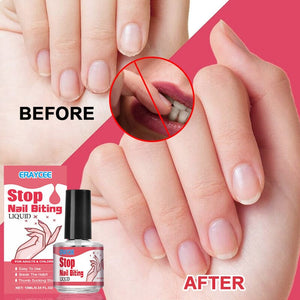 Stop Nail Biting Liquid 10ml Nail Care No Brand 