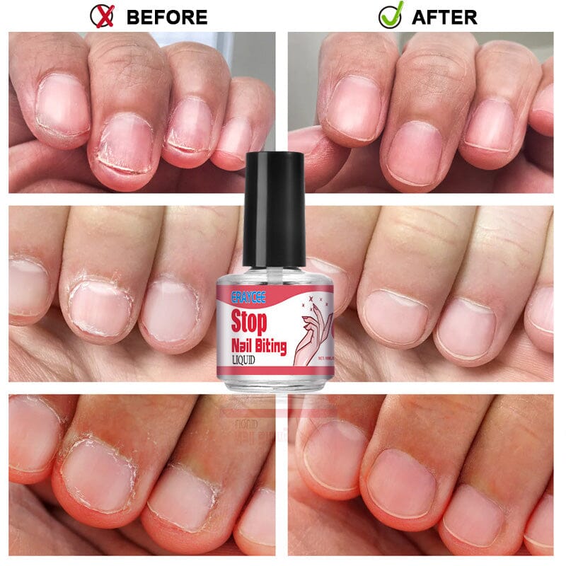 Stop Nail Biting Liquid 10ml Nail Care No Brand 