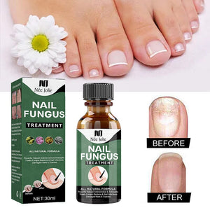 Nail Fungus Treatment Liquid NEE JOLIE 