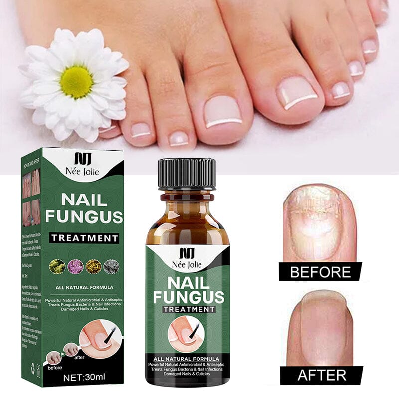 Nail Fungus Treatment Liquid NEE JOLIE 